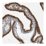 Atlas Antibodies Anti-PHIP Antibody