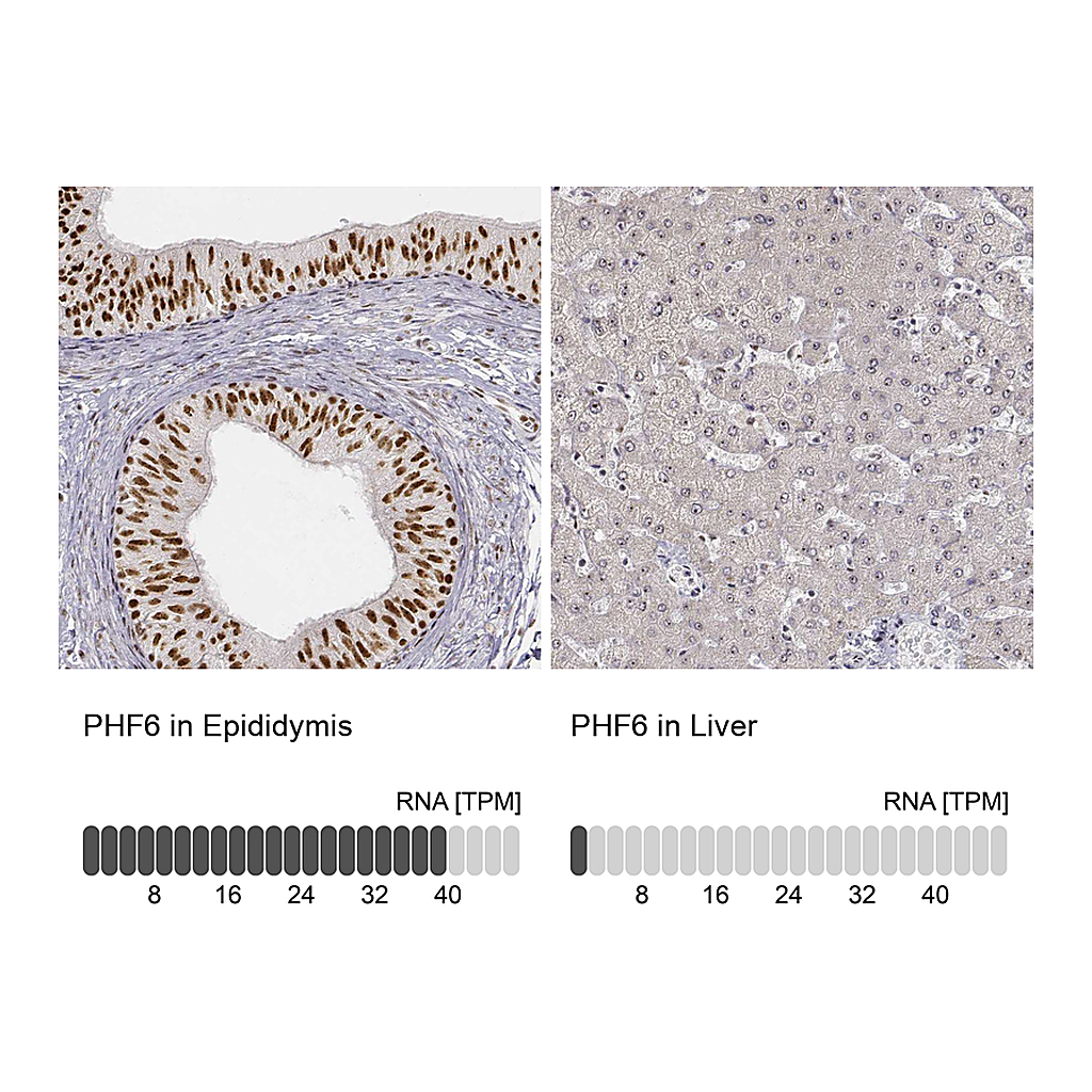 Atlas Antibodies Anti-PHF6 Antibody