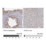Atlas Antibodies Anti-PHF6 Antibody
