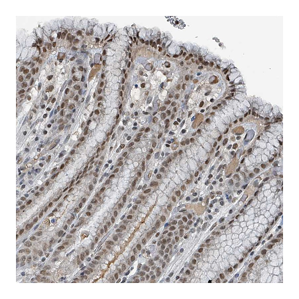 Atlas Antibodies Anti-PHIP Antibody
