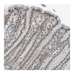 Atlas Antibodies Anti-PHIP Antibody