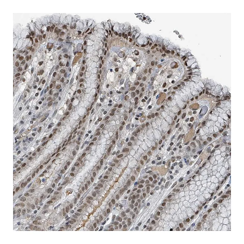 Atlas Antibodies Anti-PHIP Antibody