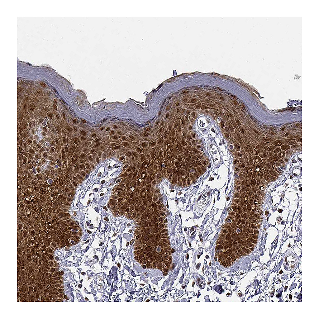 Atlas Antibodies Anti-PHGDH Antibody