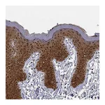 Atlas Antibodies Anti-PHGDH Antibody