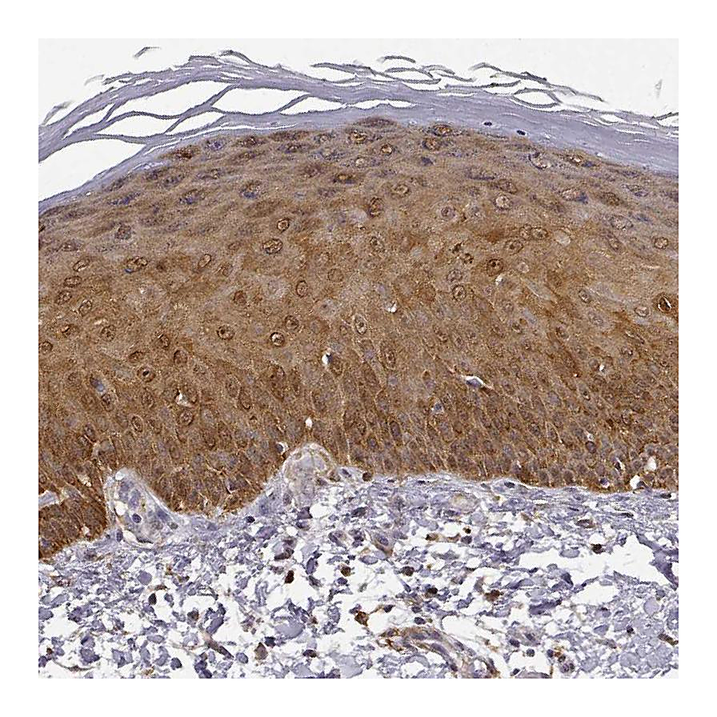 Atlas Antibodies Anti-PHGDH Antibody