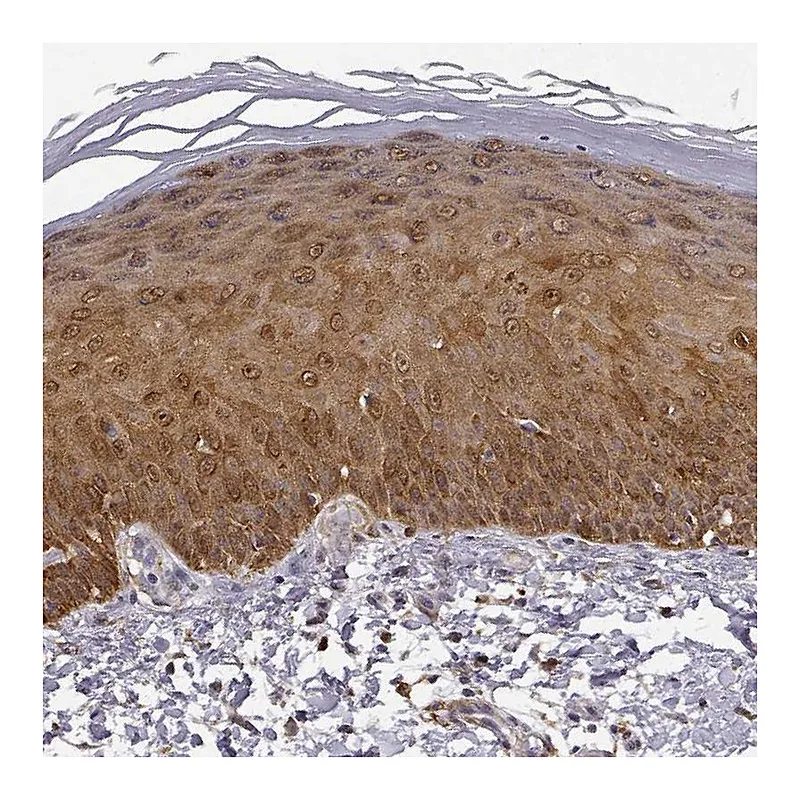 Atlas Antibodies Anti-PHGDH Antibody