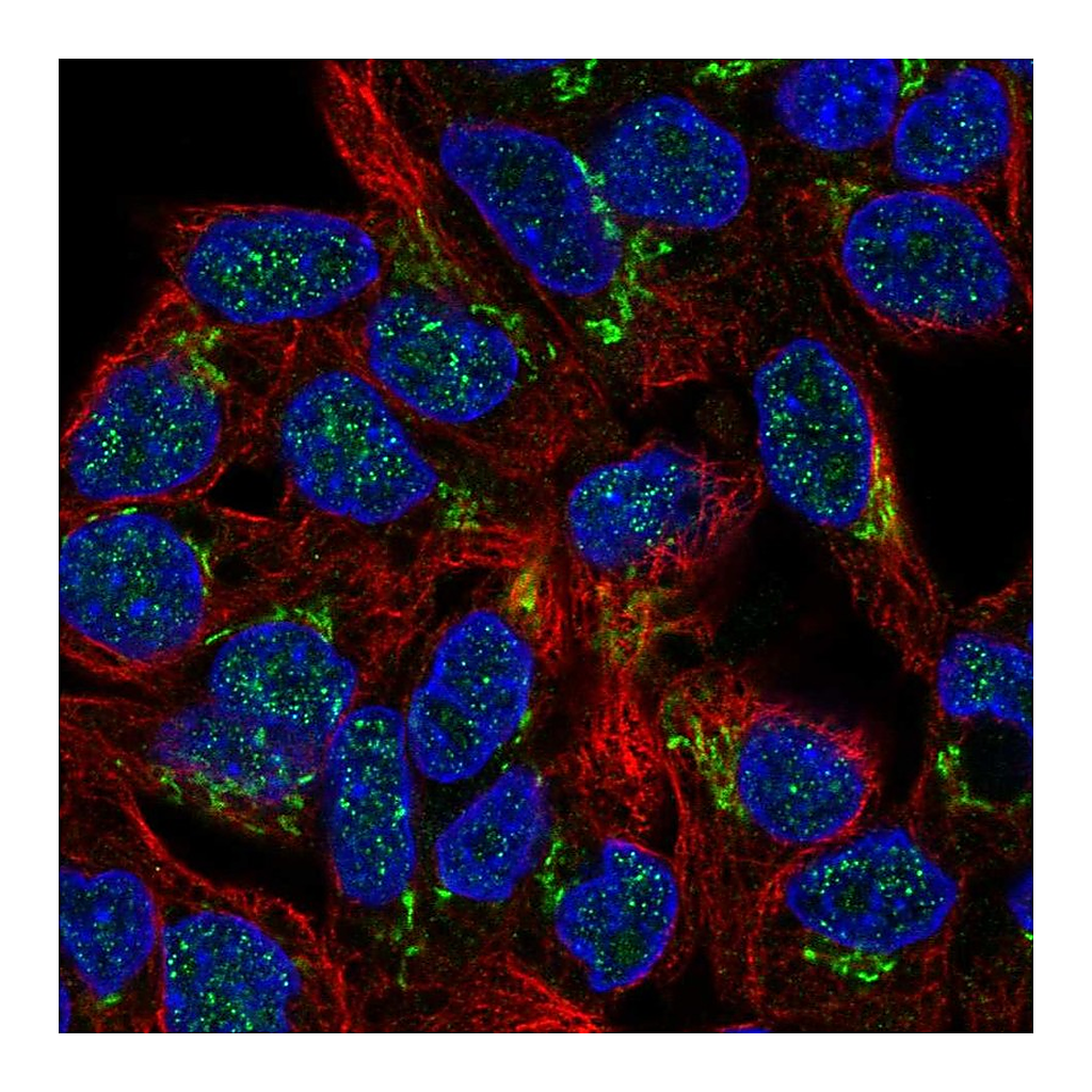 Atlas Antibodies Anti-PHKB Antibody
