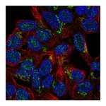 Atlas Antibodies Anti-PHKB Antibody