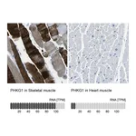 Atlas Antibodies Anti-PHKG1 Antibody