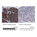 Atlas Antibodies Anti-PHKA1 Antibody