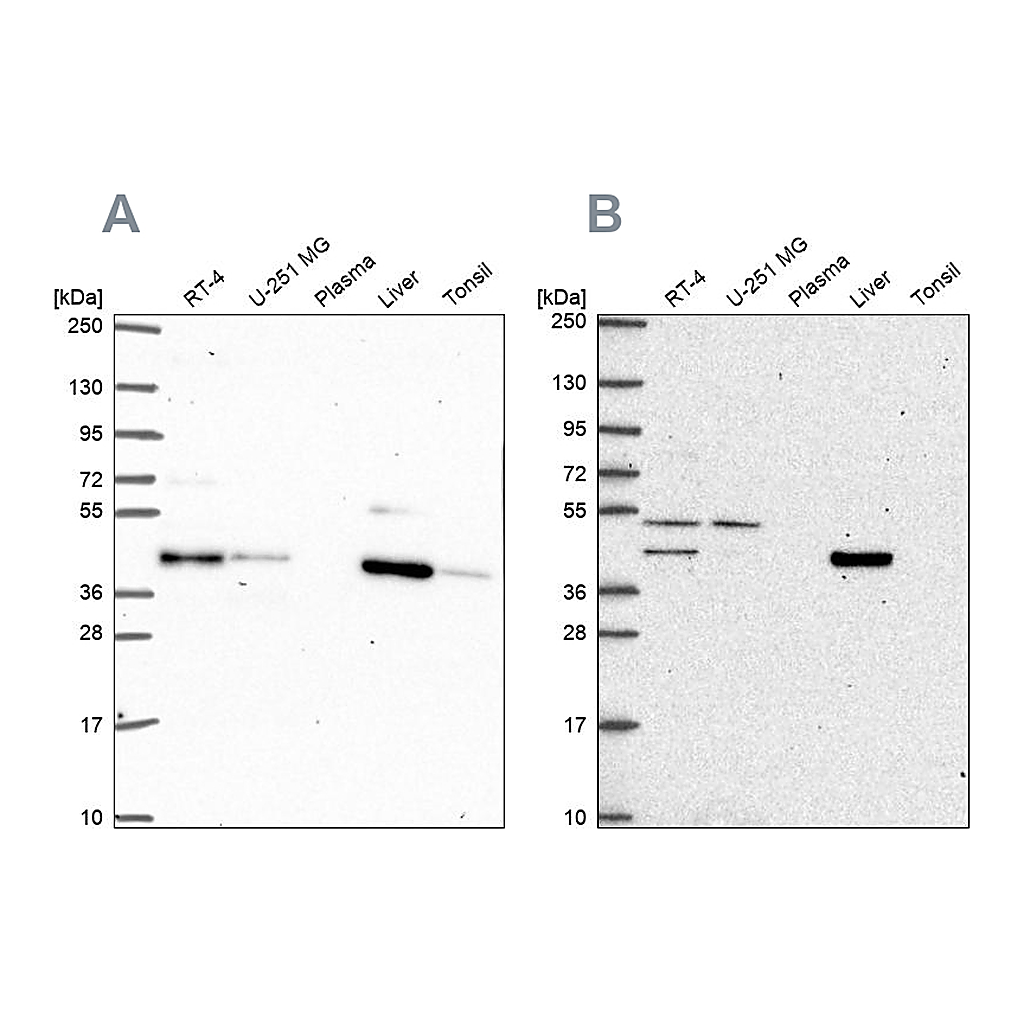 Atlas Antibodies Anti-PHKG2 Antibody