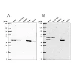 Atlas Antibodies Anti-PHKG2 Antibody