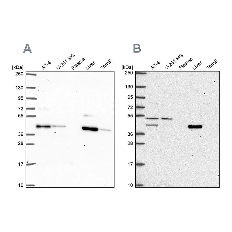 Atlas Antibodies Anti-PHKG2 Antibody