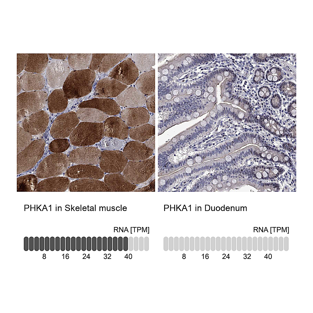 Atlas Antibodies Anti-PHKA1 Antibody