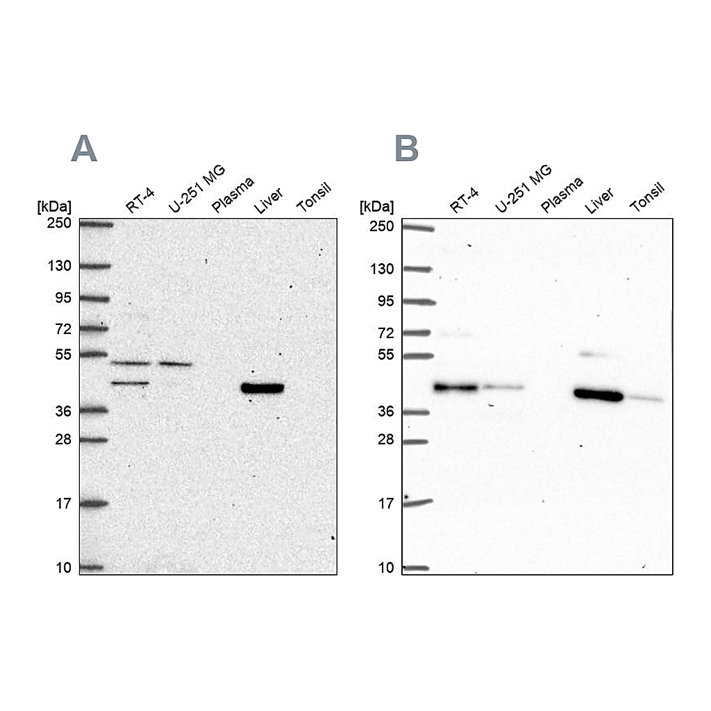 Atlas Antibodies Anti-PHKG2 Antibody