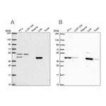 Atlas Antibodies Anti-PHKG2 Antibody