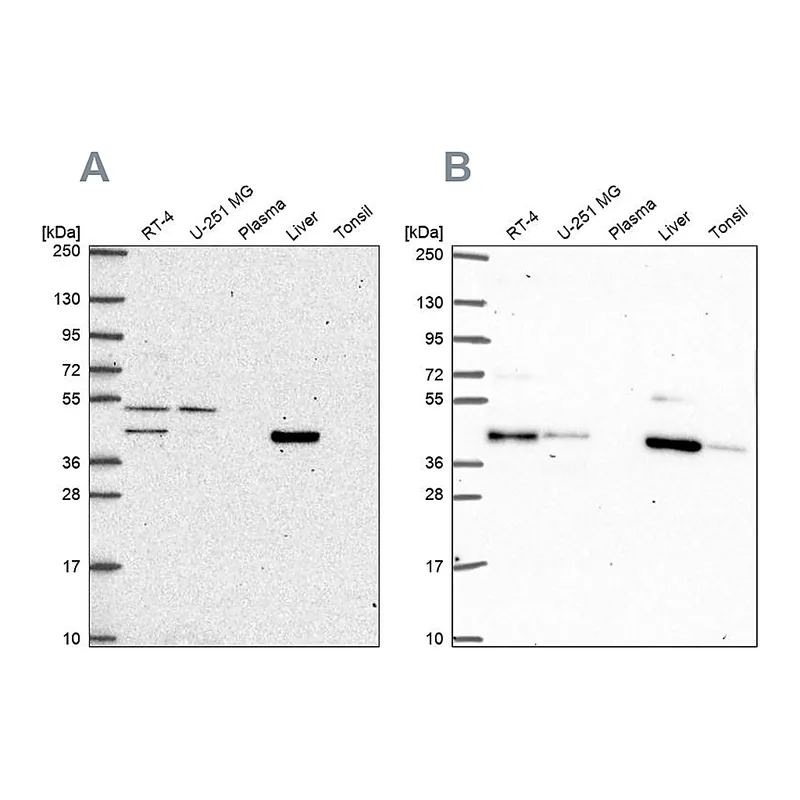 Atlas Antibodies Anti-PHKG2 Antibody