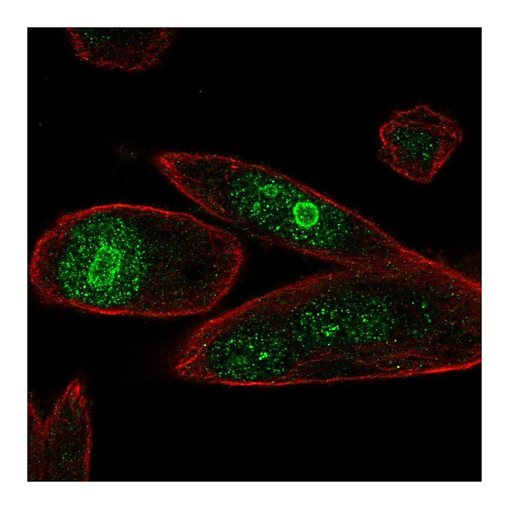 Atlas Antibodies Anti-PHLDA1 Antibody