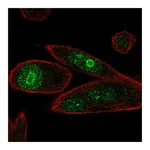 Atlas Antibodies Anti-PHLDA1 Antibody