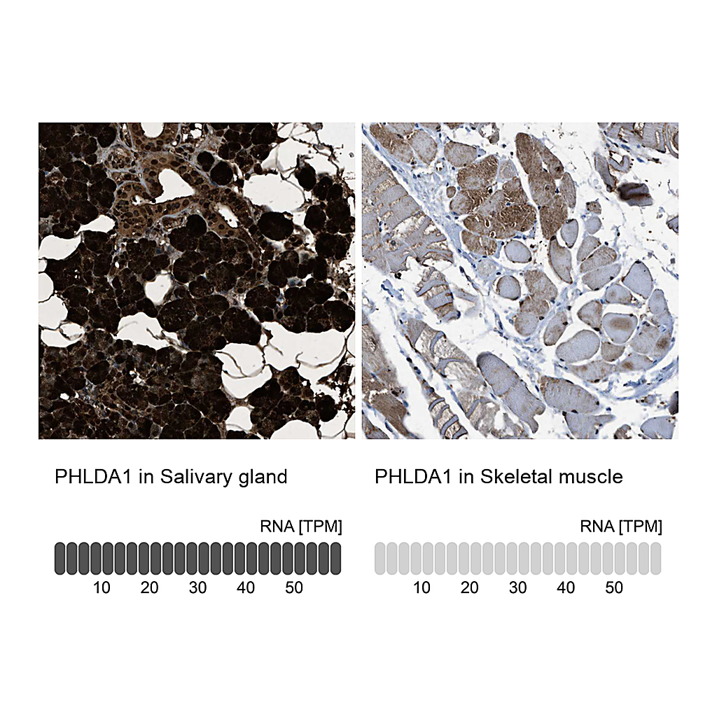 Atlas Antibodies Anti-PHLDA1 Antibody