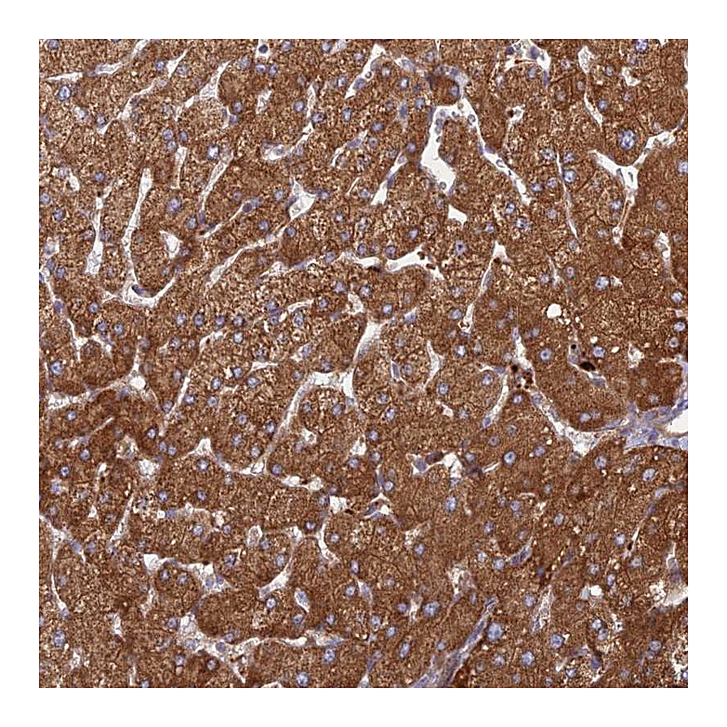 Atlas Antibodies Anti-PHKA2 Antibody