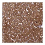 Atlas Antibodies Anti-PHKA2 Antibody