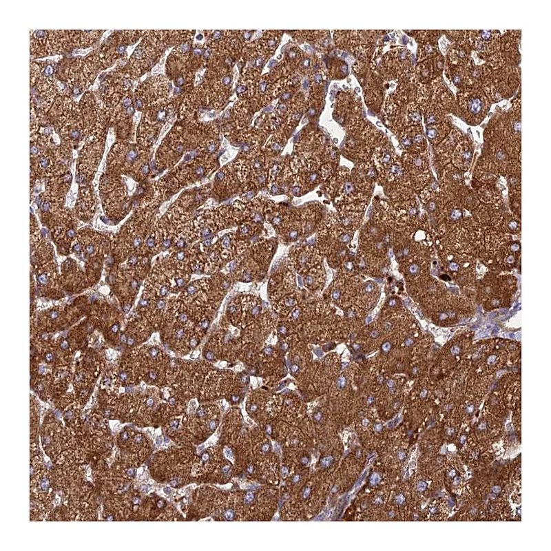Atlas Antibodies Anti-PHKA2 Antibody