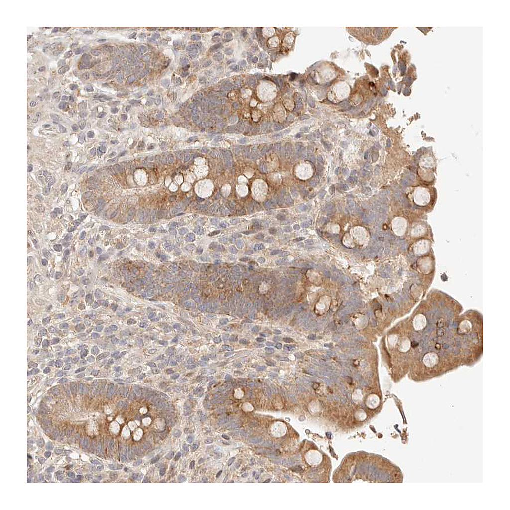Atlas Antibodies Anti-PHLDA3 Antibody