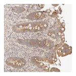 Atlas Antibodies Anti-PHLDA3 Antibody