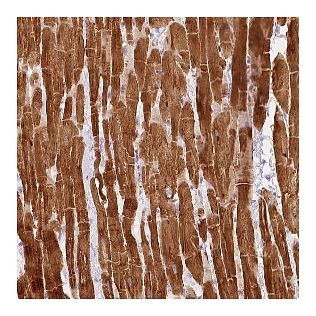 Atlas Antibodies Anti-PHOSPHO1 Antibody