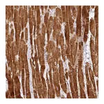 Atlas Antibodies Anti-PHOSPHO1 Antibody