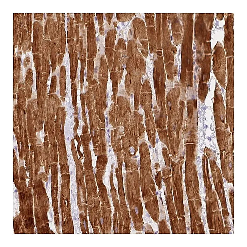 Atlas Antibodies Anti-PHOSPHO1 Antibody