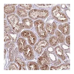 Atlas Antibodies Anti-PHLDB1 Antibody