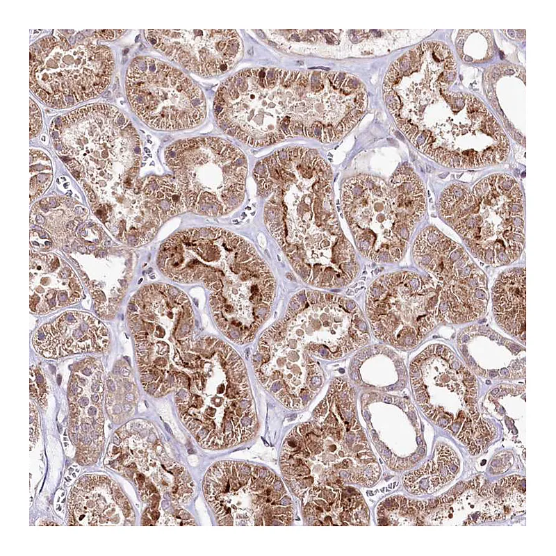 Atlas Antibodies Anti-PHLDB1 Antibody