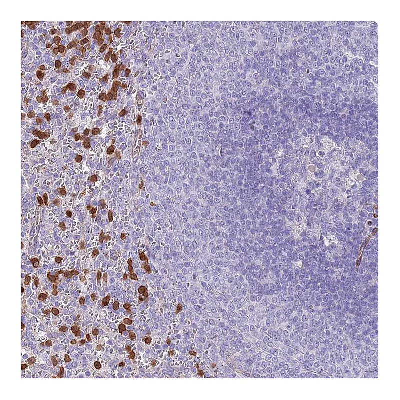 Atlas Antibodies Anti-PHLPP2 Antibody