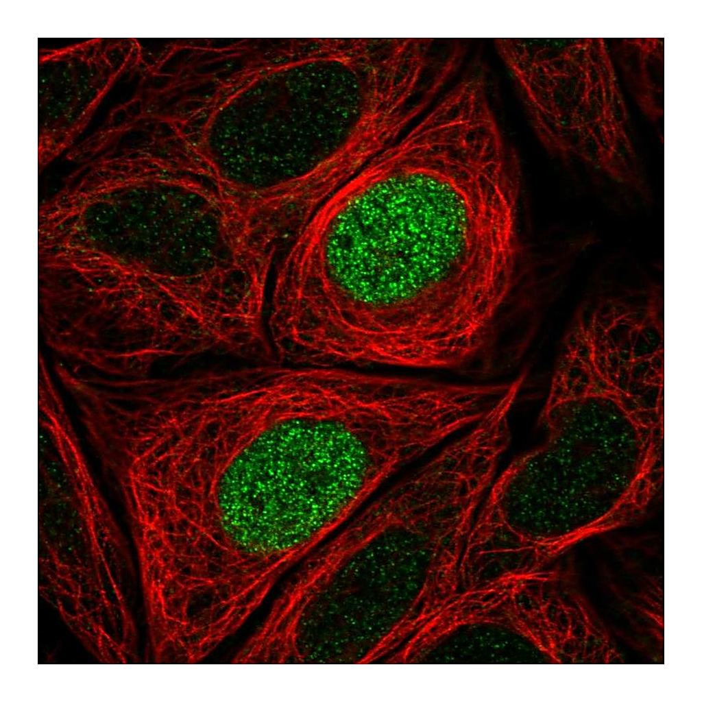 Atlas Antibodies Anti-PHLDB1 Antibody