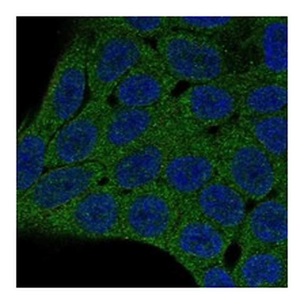 Atlas Antibodies Anti-PHLPP2 Antibody