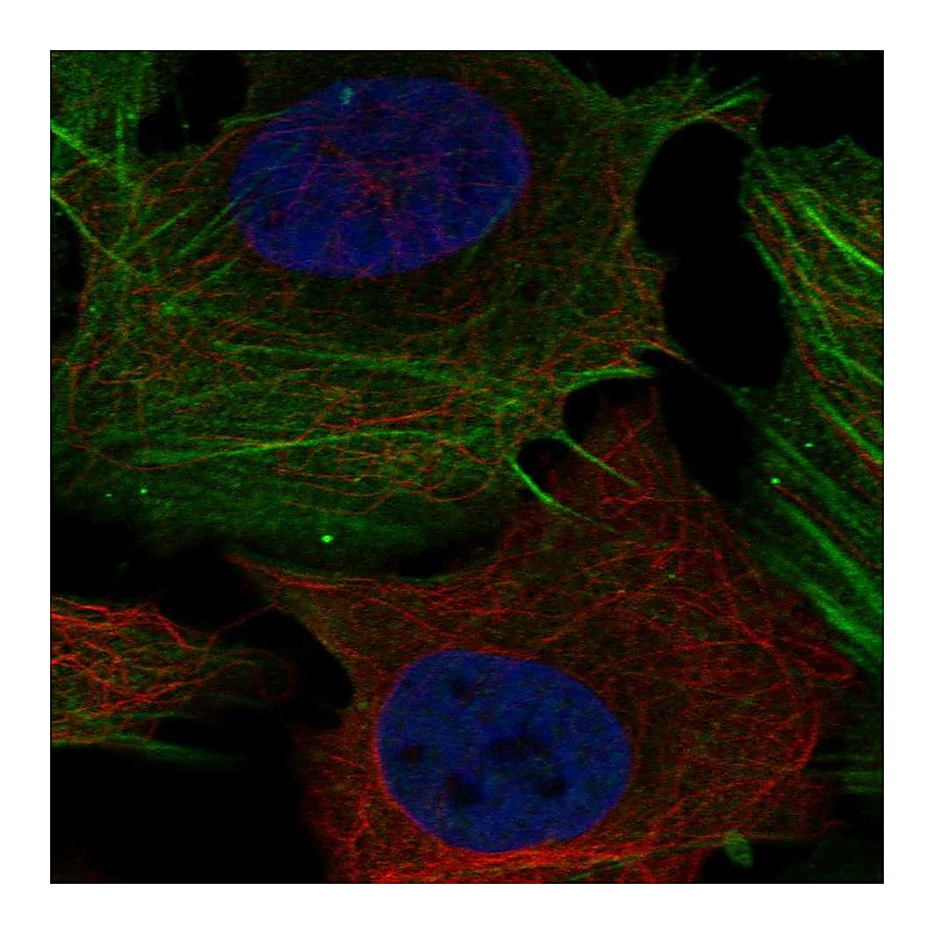 Atlas Antibodies Anti-PHOSPHO1 Antibody