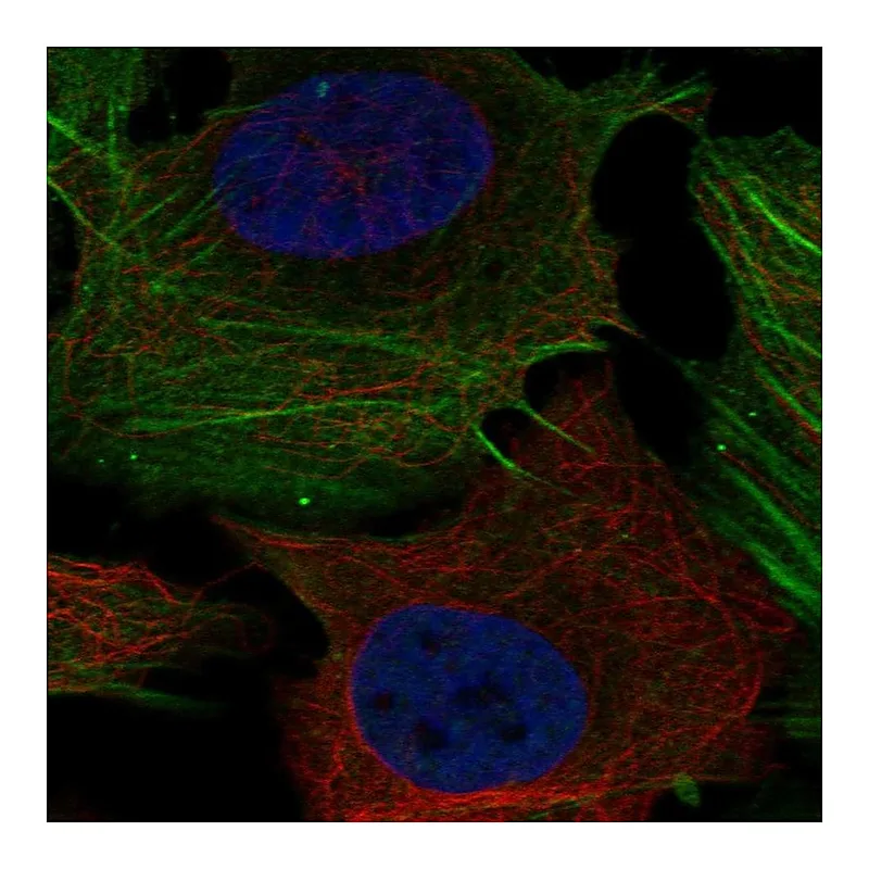 Atlas Antibodies Anti-PHOSPHO1 Antibody