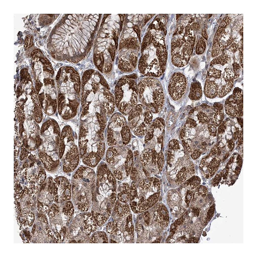 Atlas Antibodies Anti-PHLDB2 Antibody