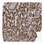 Atlas Antibodies Anti-PHLDB2 Antibody