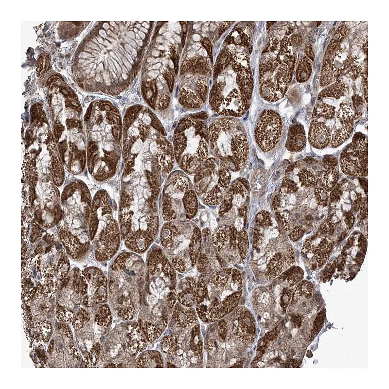 Atlas Antibodies Anti-PHLDB2 Antibody