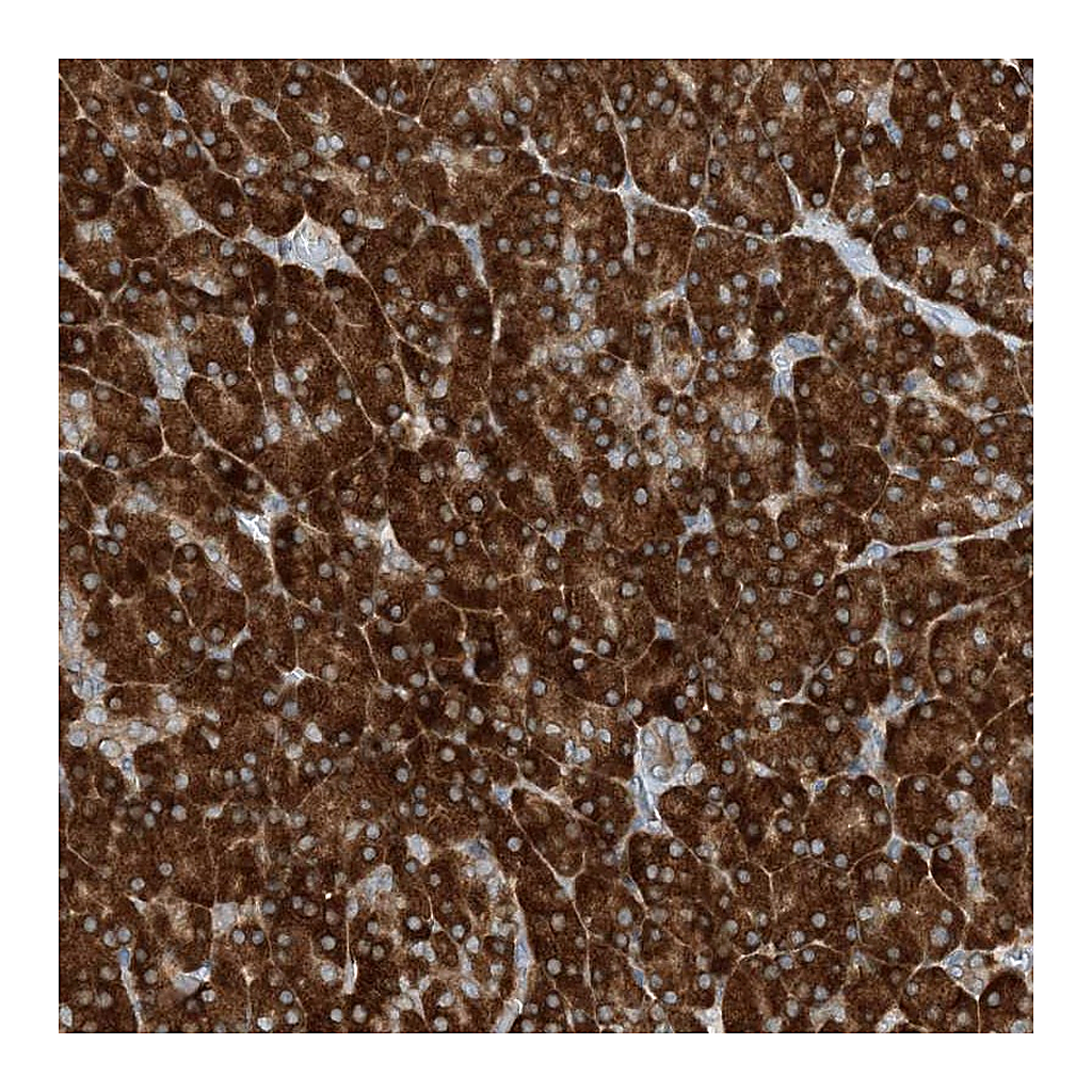 Atlas Antibodies Anti-PHOSPHO2 Antibody