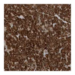 Atlas Antibodies Anti-PHOSPHO2 Antibody