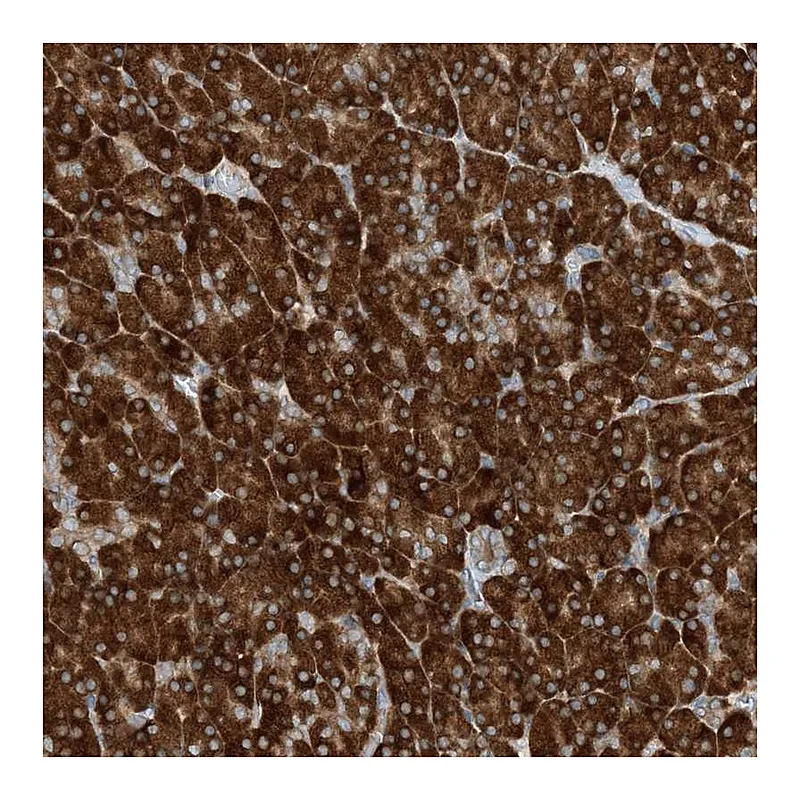 Atlas Antibodies Anti-PHOSPHO2 Antibody