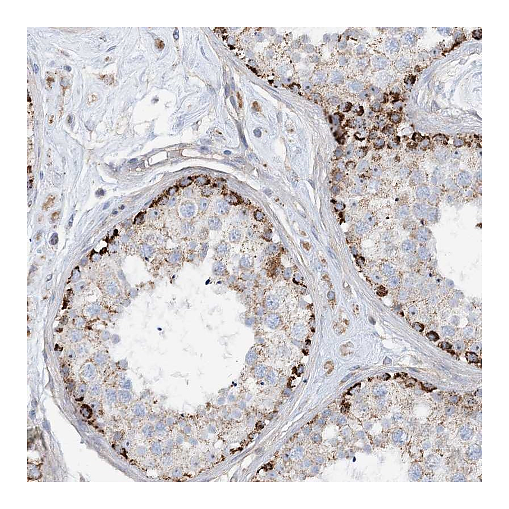 Atlas Antibodies Anti-PHOSPHO2 Antibody