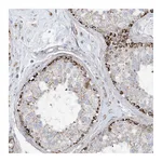 Atlas Antibodies Anti-PHOSPHO2 Antibody