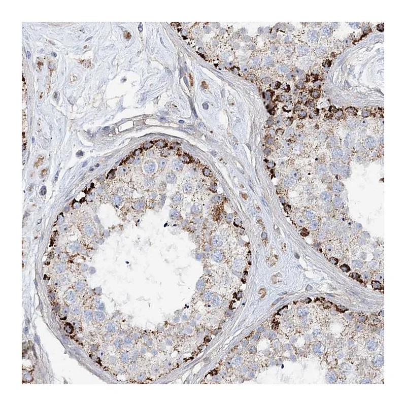 Atlas Antibodies Anti-PHOSPHO2 Antibody