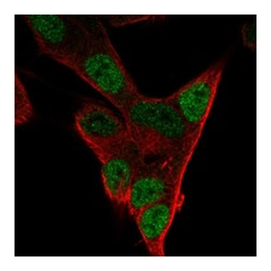 Atlas Antibodies Anti-PHOX2A Antibody