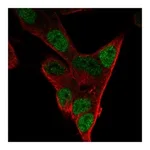 Atlas Antibodies Anti-PHOX2A Antibody
